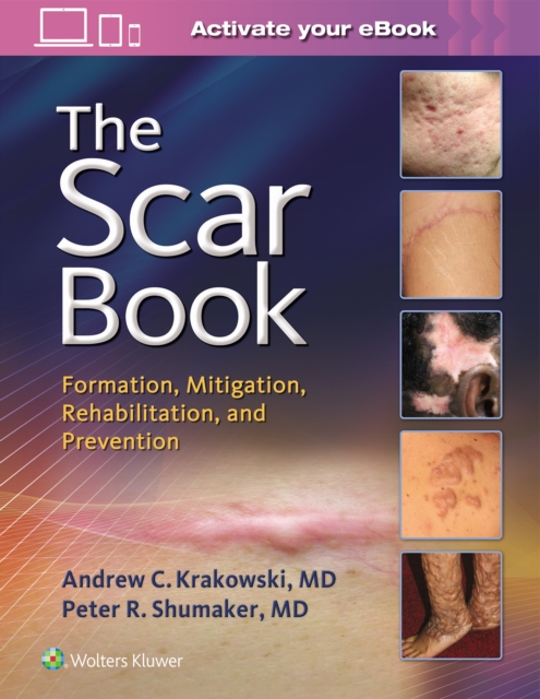 The Scar Book : Formation, Mitigation, Rehabilitation and Prevention, Hardback Book