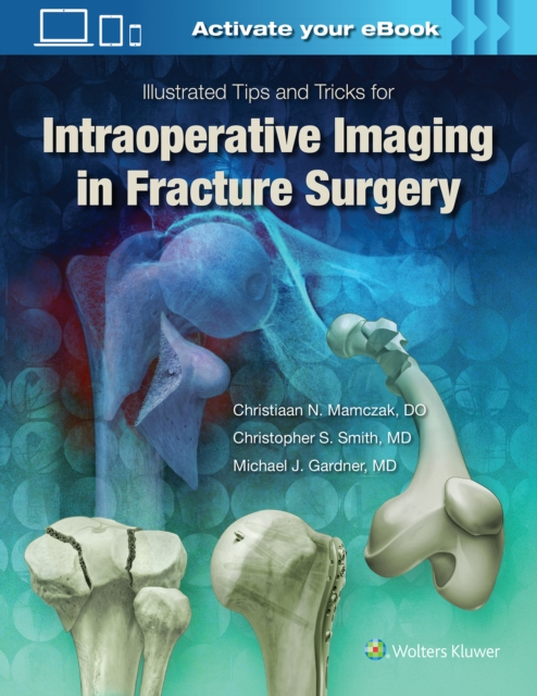 Illustrated Tips and Tricks for Intraoperative Imaging in Fracture Surgery, Hardback Book