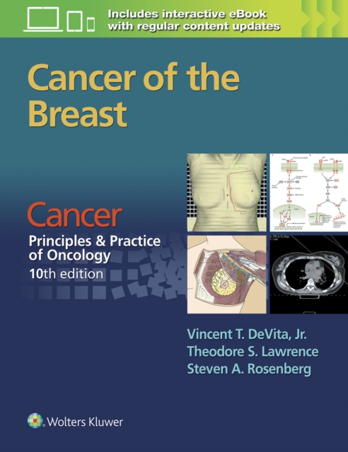Cancer of the Breast : From Cancer:  Principles & Practice of Oncology, 10th edition, Paperback / softback Book