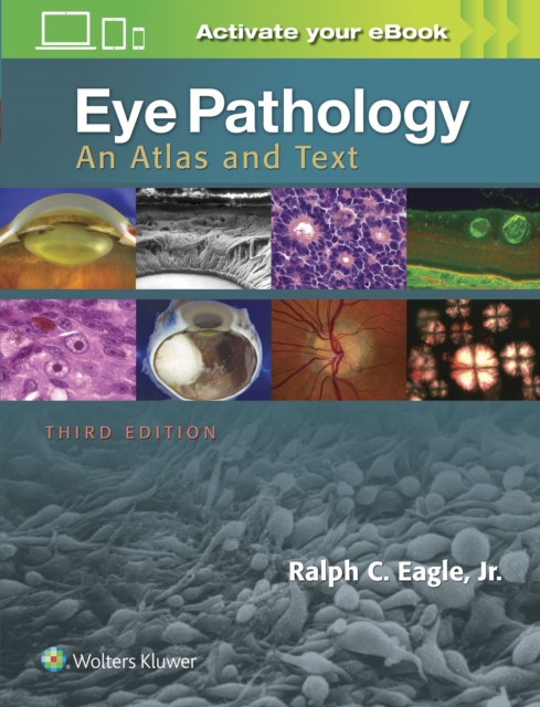 Eye Pathology : An Atlas and Text, Hardback Book