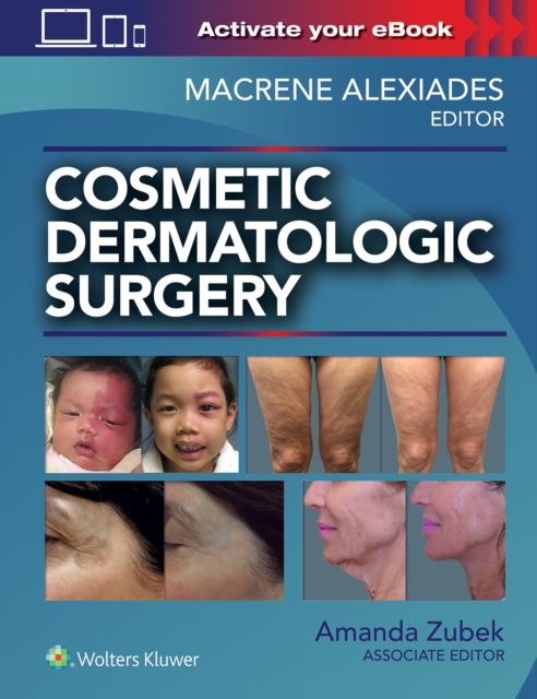 Cosmetic Dermatologic Surgery, Hardback Book