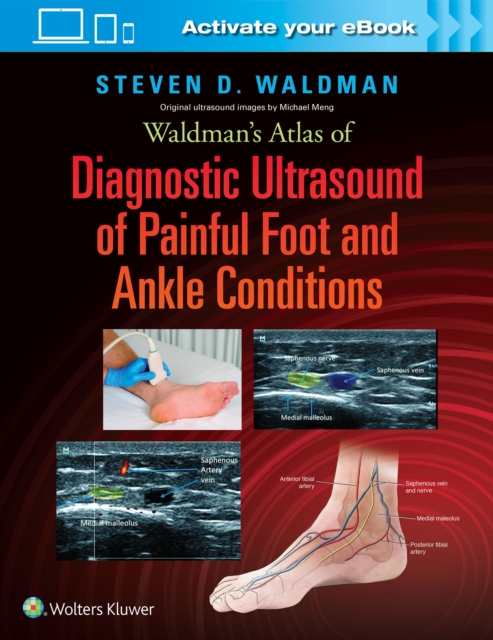 Waldman's Atlas of Diagnostic Ultrasound of Painful Foot and Ankle Conditions, Hardback Book