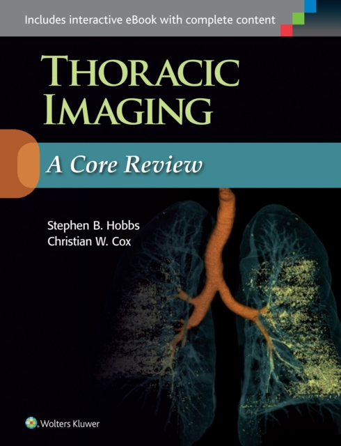 Thoracic Imaging: A Core Review, Paperback / softback Book