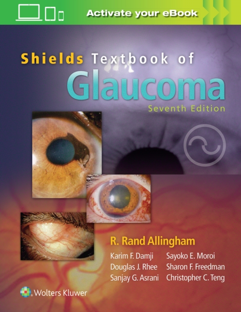 Shields' Textbook of Glaucoma, Hardback Book
