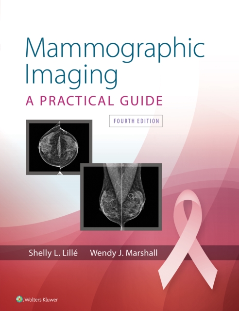 Mammographic Imaging, EPUB eBook
