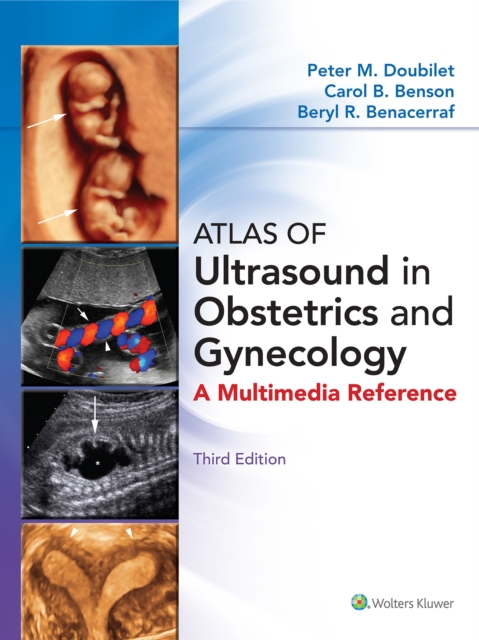 Atlas of Ultrasound in Obstetrics and Gynecology, EPUB eBook