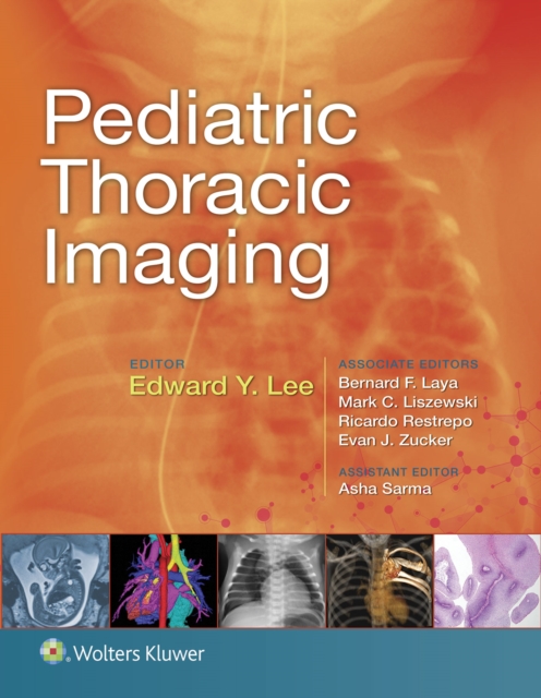 Pediatric Thoracic Imaging, EPUB eBook