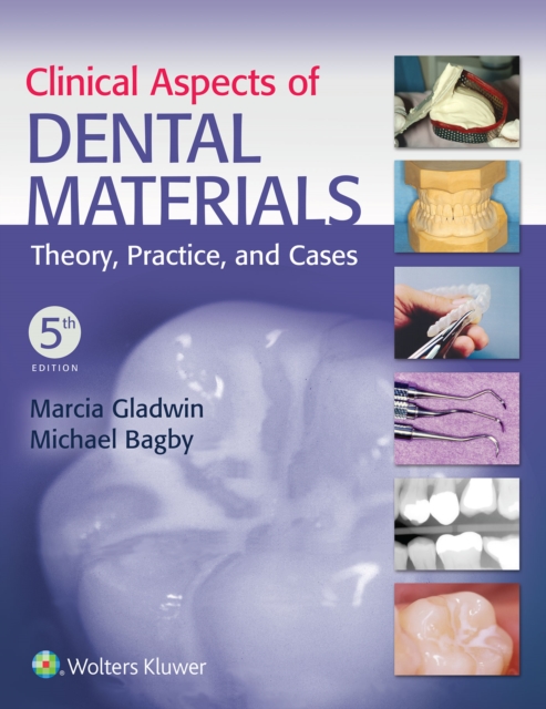 Clinical Aspects of Dental Materials : Theory, Practice, and Cases, Paperback Book