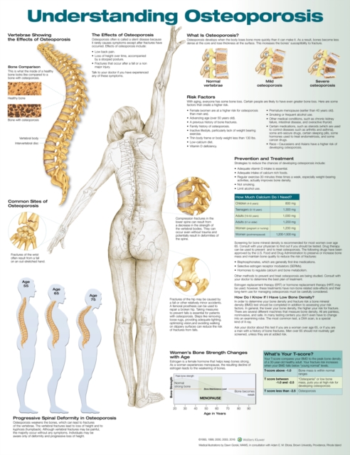 Understanding Osteoporosis Anatomical Chart, Wallchart Book