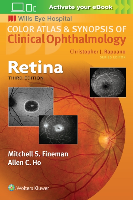 Retina, Paperback / softback Book