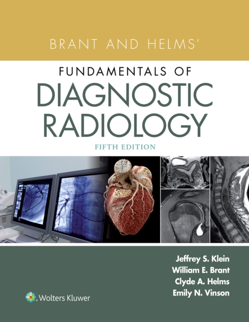 Brant and Helms' Fundamentals of Diagnostic Radiology, EPUB eBook