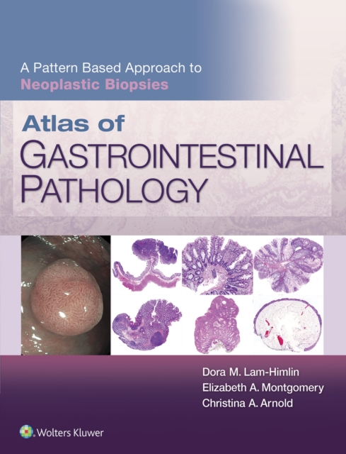 Atlas of Gastrointestinal Pathology: A Pattern Based Approach to Neoplastic Biopsies, EPUB eBook