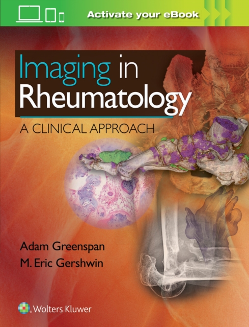 Imaging in Rheumatology : A Clinical Approach, Hardback Book
