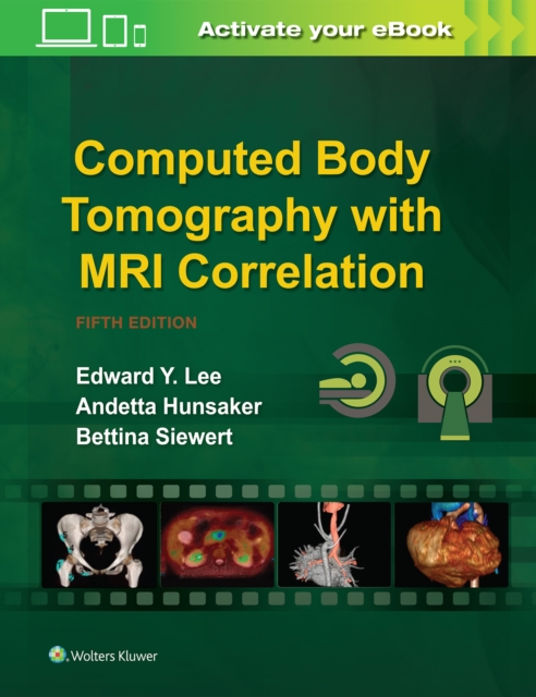Computed Body Tomography with MRI Correlation, Hardback Book