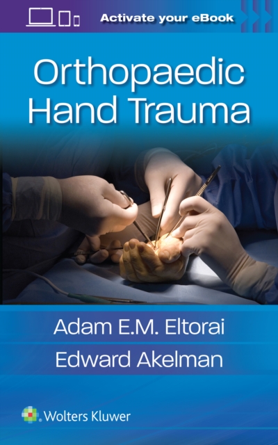 Orthopaedic Hand Trauma, Paperback / softback Book