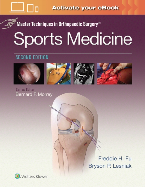 Master Techniques in Orthopaedic Surgery: Sports Medicine, Hardback Book