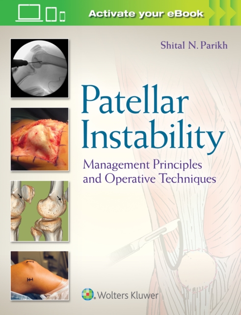 Patellar Instability : Management Principles and Operative Techniques, Hardback Book