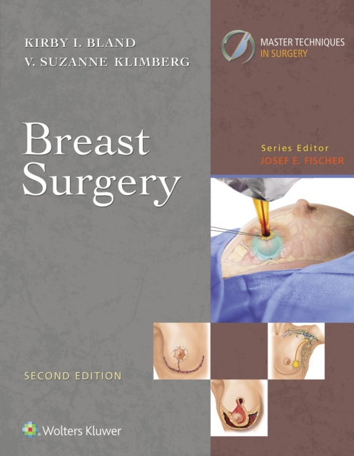 Master Techniques in Surgery: Breast Surgery, EPUB eBook