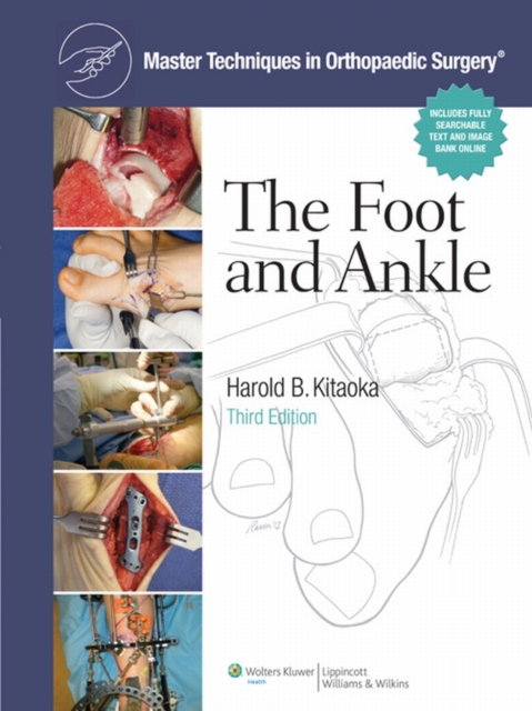 Master Techniques in Orthopaedic Surgery: Foot and Ankle, EPUB eBook