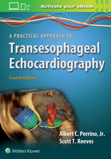 A Practical Approach to Transesophageal Echocardiography, Paperback / softback Book
