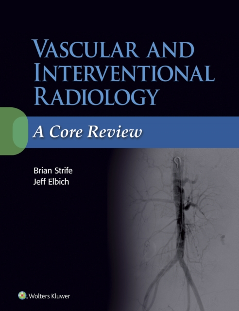 Vascular and Interventional Radiology: A Core Review, EPUB eBook