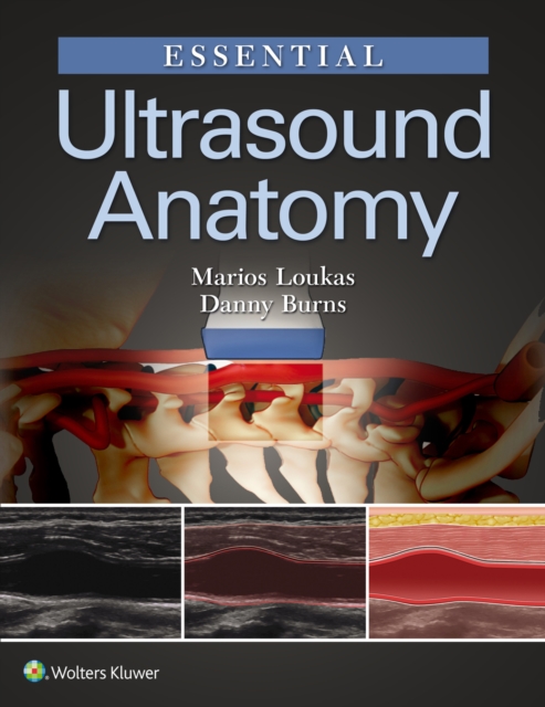 Essential Ultrasound Anatomy, EPUB eBook