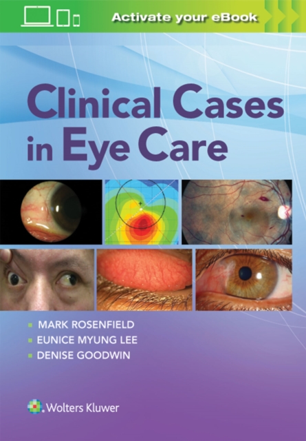 Clinical Cases in Eye Care, Paperback / softback Book