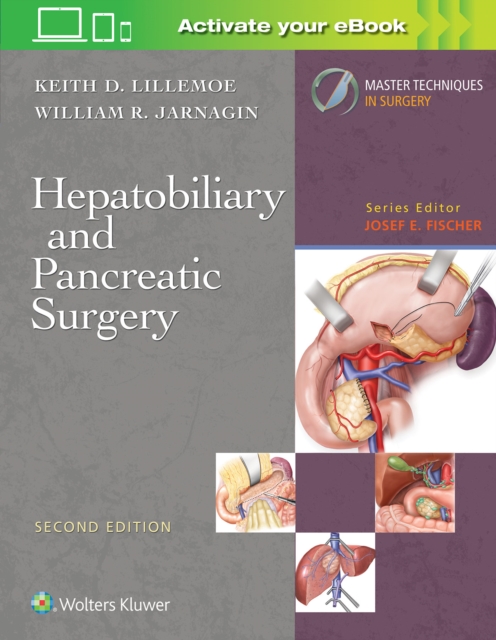 Master Techniques in Surgery: Hepatobiliary and Pancreatic Surgery, Hardback Book