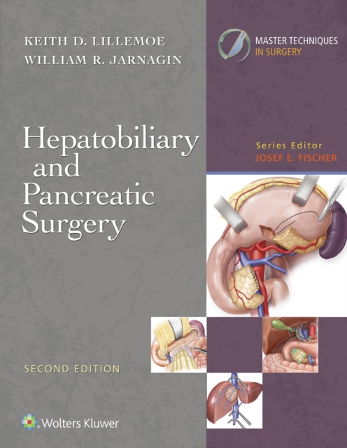 Master Techniques in Surgery: Hepatobiliary and Pancreatic Surgery, EPUB eBook