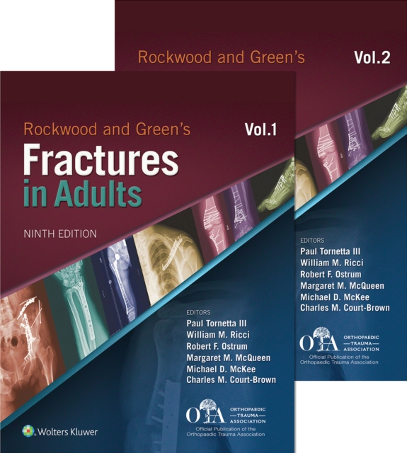 Rockwood and Green's Fractures in Adults, EPUB eBook