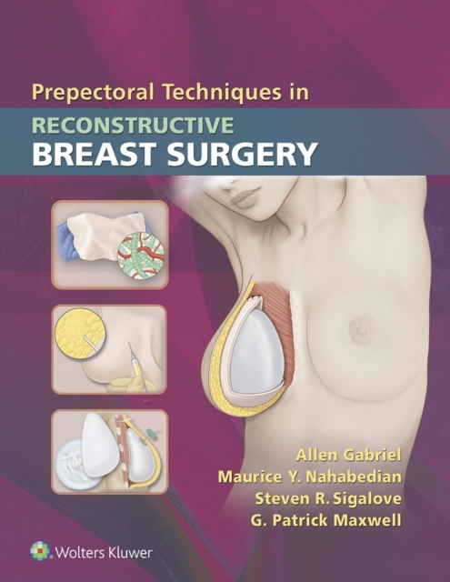 Prepectoral Techniques in Reconstructive Breast Surgery, EPUB eBook
