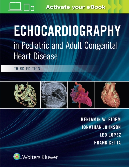 Echocardiography in Pediatric and Adult Congenital Heart Disease, Hardback Book