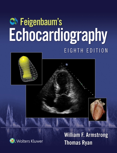 Feigenbaum's Echocardiography: Ebook without Multimedia, EPUB eBook