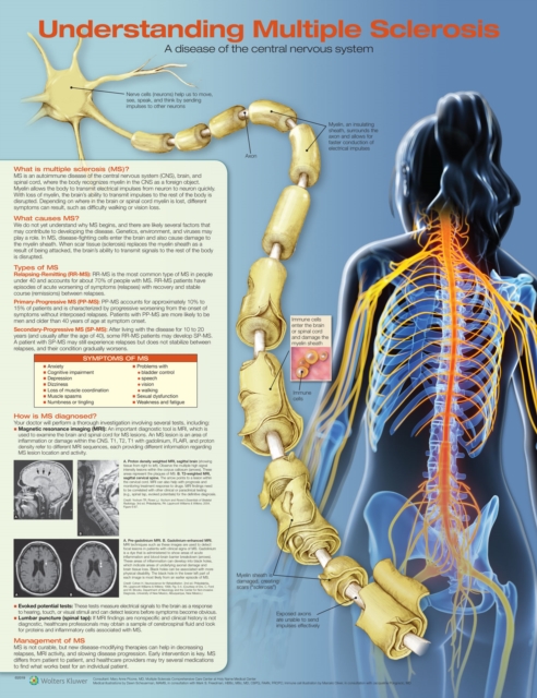 Understanding Multiple Sclerosis Anatomical Chart, Wallchart Book