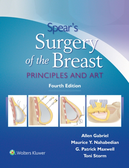 Spear's Surgery of the Breast : Principles and Art, EPUB eBook