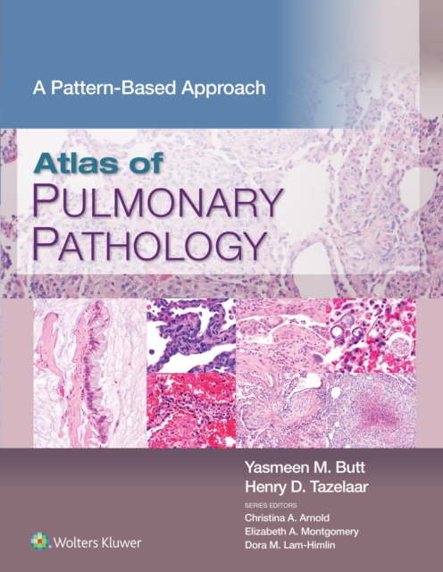 Atlas of Pulmonary Pathology : A Pattern Based Approach, EPUB eBook