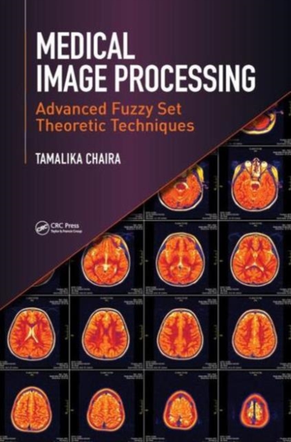 Medical Image Processing : Advanced Fuzzy Set Theoretic Techniques, Hardback Book