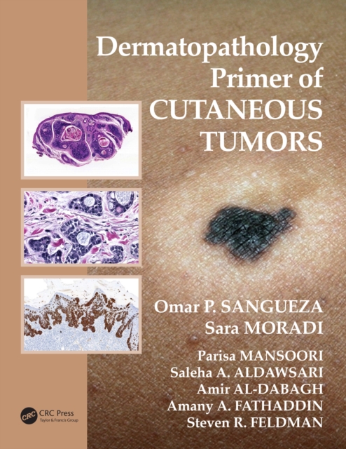 Dermatopathology Primer of Cutaneous Tumors, PDF eBook