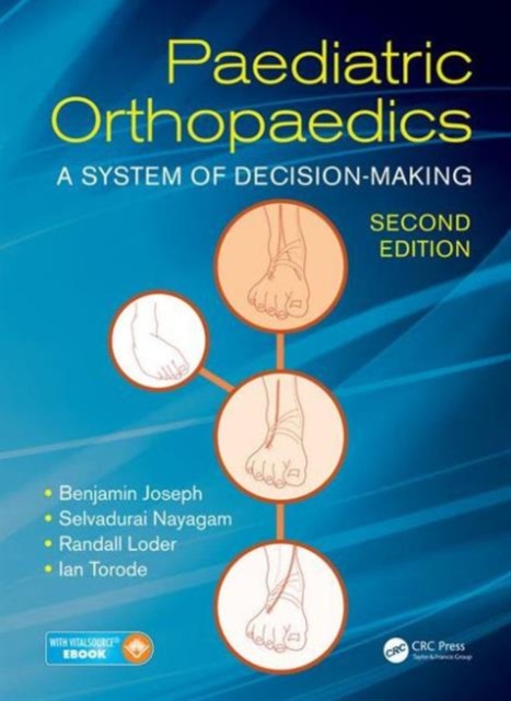Paediatric Orthopaedics : A System of Decision-Making, Second Edition, Hardback Book
