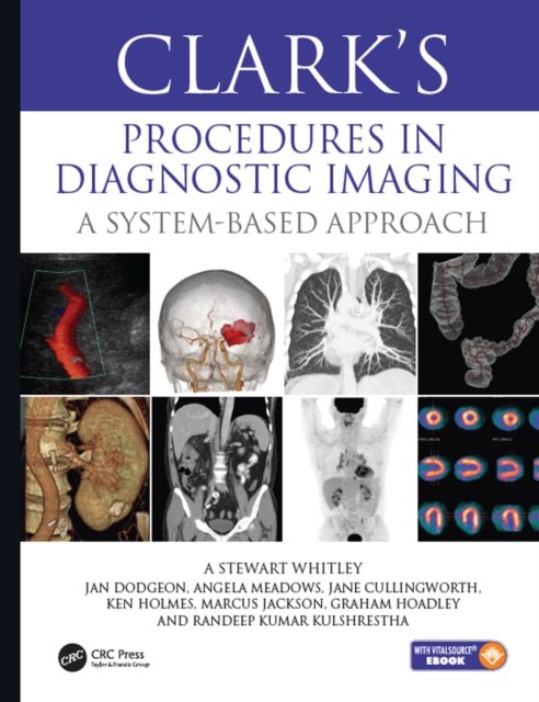 Clark’s Procedures in Diagnostic Imaging : A System-Based Approach, EPUB eBook