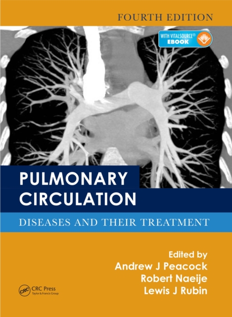 Pulmonary Circulation : Diseases and Their Treatment, Fourth Edition, PDF eBook