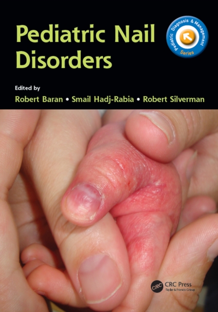 Pediatric Nail Disorders, PDF eBook