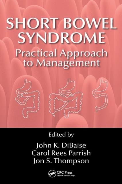 Short Bowel Syndrome : Practical Approach to Management, Hardback Book