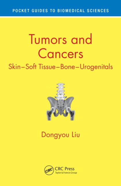 Tumors and Cancers : Skin - Soft Tissue - Bone - Urogenitals, PDF eBook