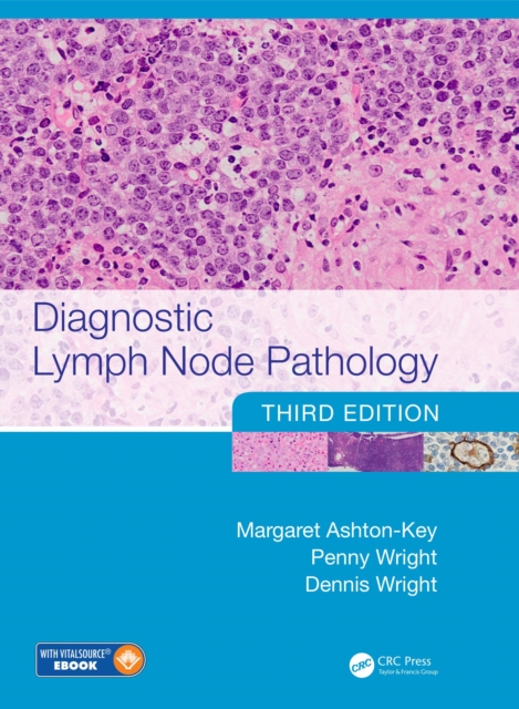 Diagnostic Lymph Node Pathology, PDF eBook