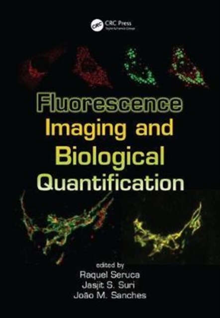 Fluorescence Imaging and Biological Quantification, Hardback Book