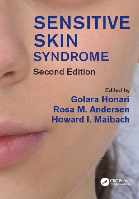 Sensitive Skin Syndrome, PDF eBook