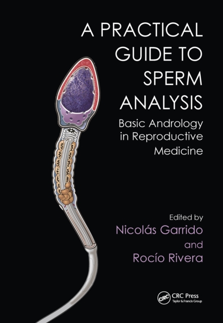 Practical Guide to Sperm Analysis : Basic Andrology in Reproductive Medicine, PDF eBook