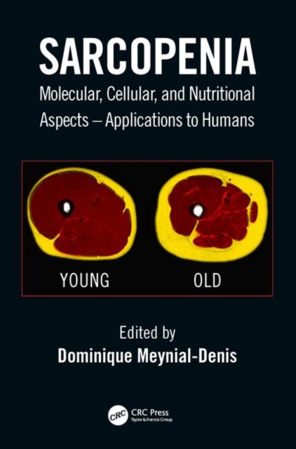 Sarcopenia : Molecular, Cellular, and Nutritional Aspects – Applications to Humans, Hardback Book