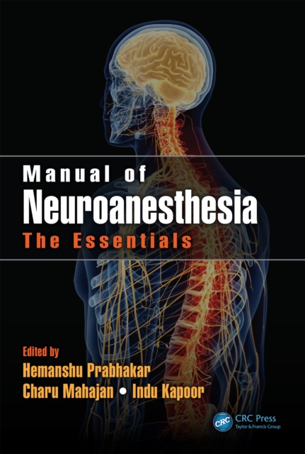 Manual of Neuroanesthesia : The Essentials, PDF eBook